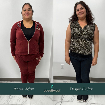 Slider image (7) Obesity Out Bariatric Surgery Center